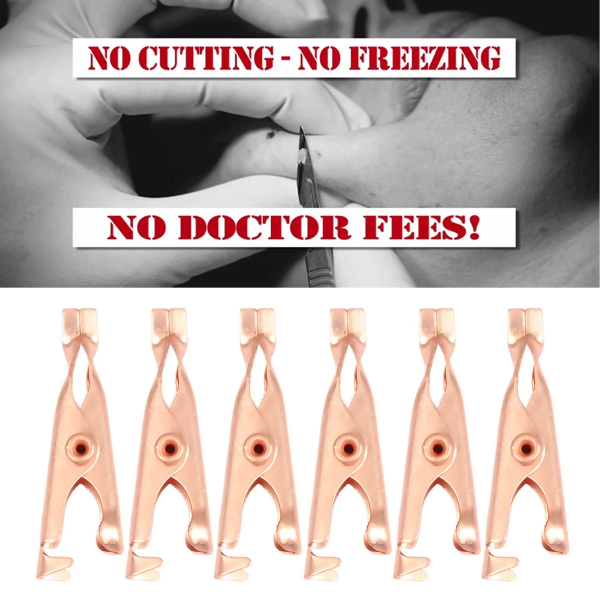 

1 коробка/12 шт., медные этикетки для удаления бородавок