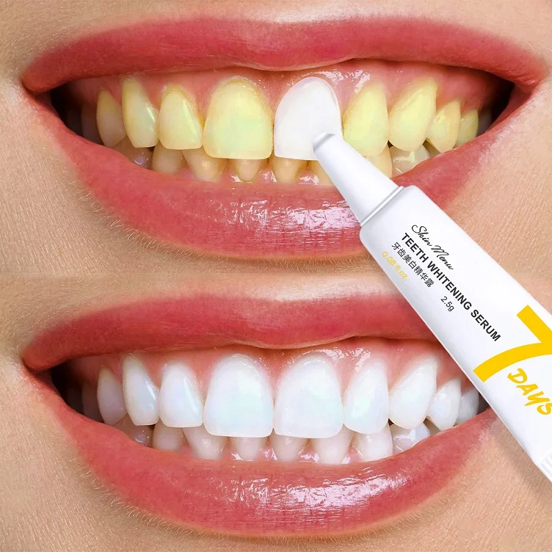 7pcs Teeth Whitening Serum Remove Tooth Stains Brighten Yellow Teeth Rice Whiten Tooth Essence Pen Gel Oral Hygiene Dental Care