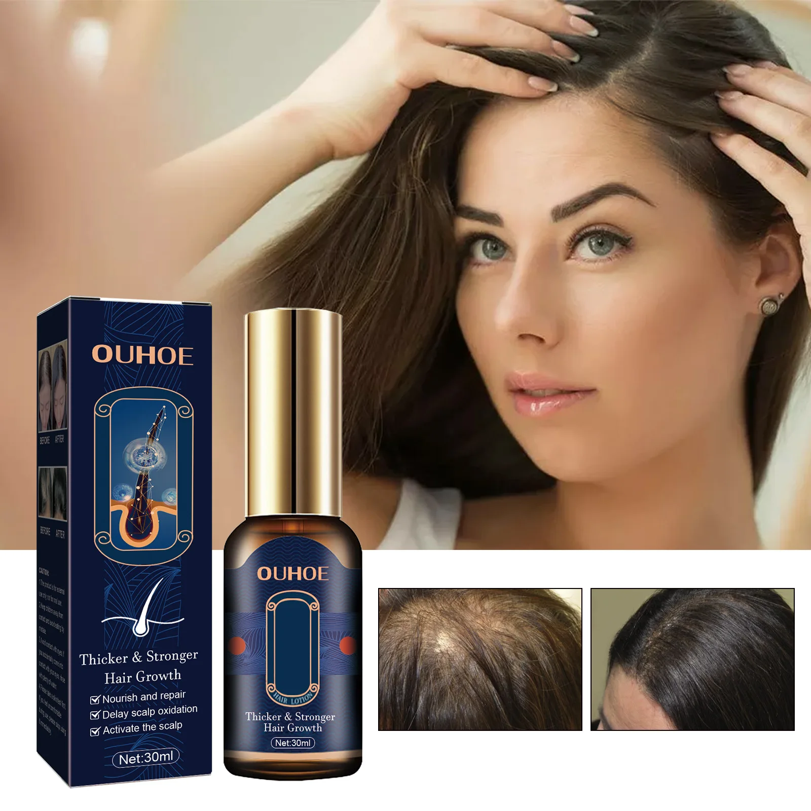 

30ml OUHOE Hair Growth Essence Spray Long Hair Efficient Anti-hair Loss Lotion Herbal Nourishing Scalp Strengthening Care Serum