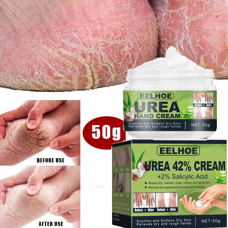

Anti Crack Foot Cream Herbal Chinese Moisture Hand Feet Mask Anti-Drying Heel Cracked Repair Calluses Dead Skin Remova Skin Care