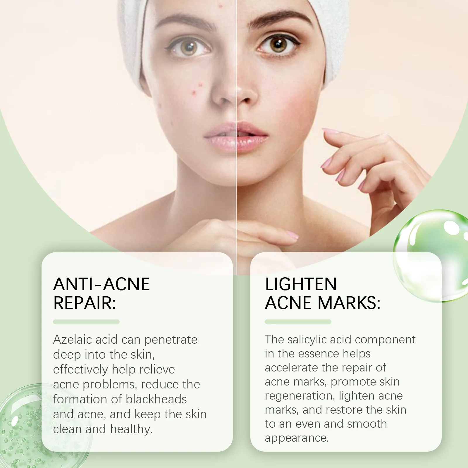 EELHOE салициловая кислота уход за лицом Сыворотка увлажняющая улучшающая кожу