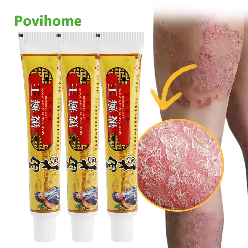 

1/3pcs Psoriasis Cream Herbal Cooling Cream Skin Fungus Anti-itch Antibacterial Rash Eczema Dermatitis Beriberi Ointment 20g