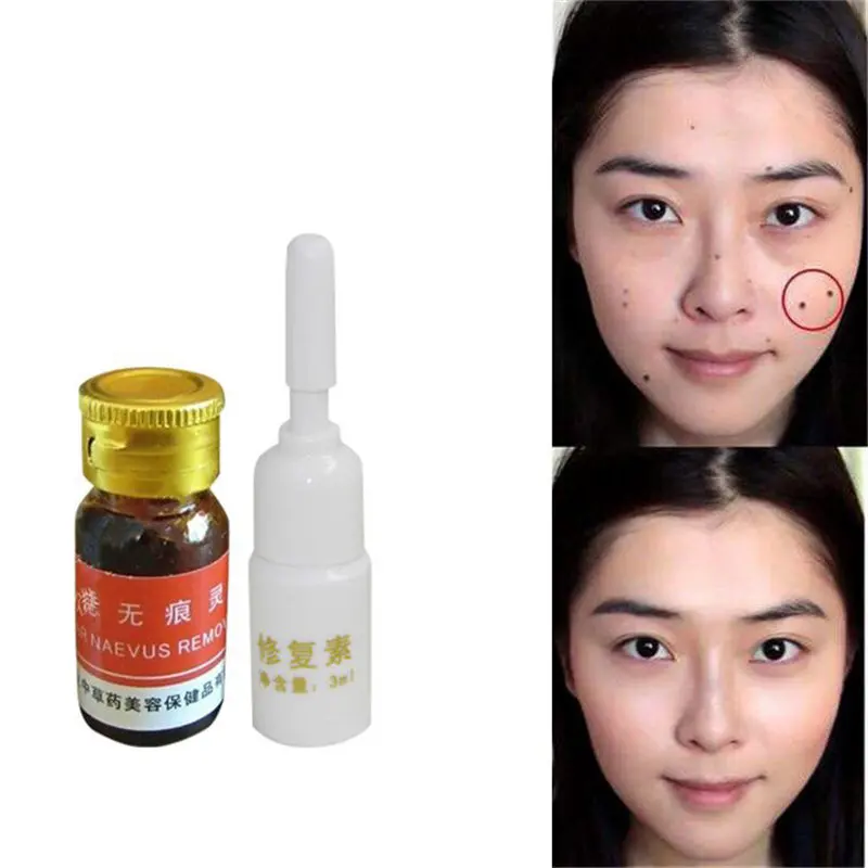 

Mole & Skin Tag Removal Solution Painless Mole Skin Dark Spot Removal Face Wart Tag Freckle Removal Cream Oil Plaster