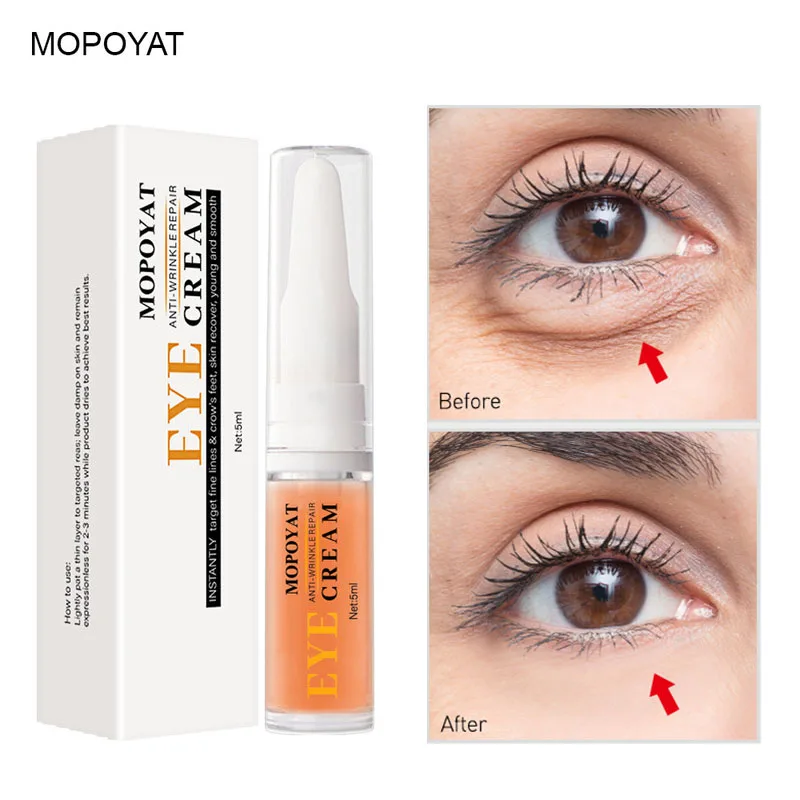 Effective Eye Cream Remove Eye Bags Under Eye Dark Circle Anti-Puffiness Essence Anti-Aging Firming Fine Lines Wrinkles Eye Care