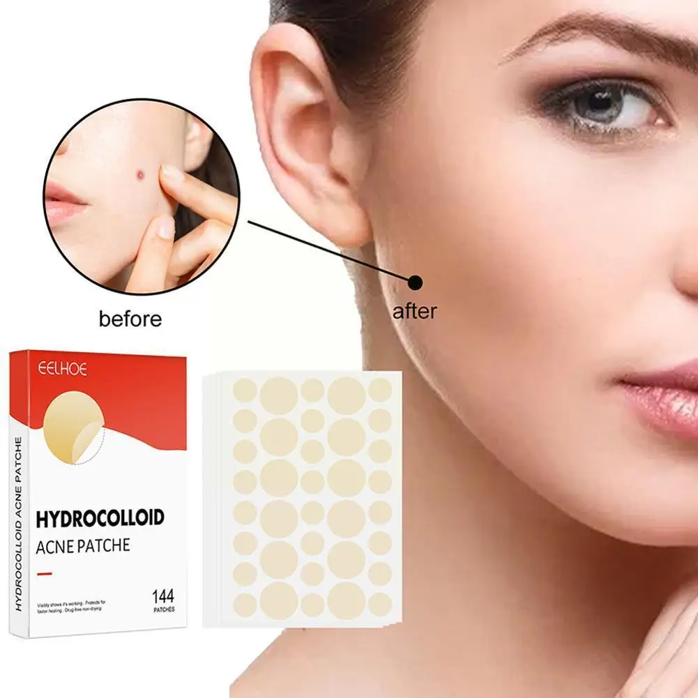 

Make-up And Closed-mouth Acne Patch Acne-proofing Waterproof Patch Breathable Patch Repair Acne Hydrocolloid Acne And Muscl A6G5