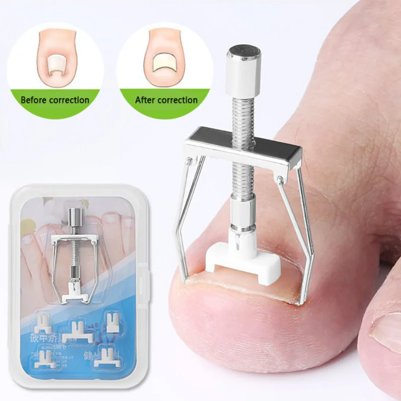 

New Ingrown Toe Nail Recover Correction Tool Pedicure Toenail Fixer Foot Nail Care Tool Orthotic Nail Corrector Pedicure Tool
