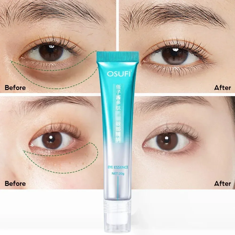 Сыворотка для области вокруг глаз от Тёмных кругов и мешков под глазами