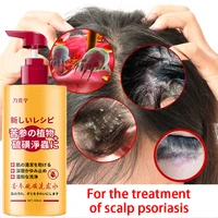 400ml hair psoriasis seborrheic skin care treatment dermatitis eczema compound herbal shampoo repair scalp remove dandruff