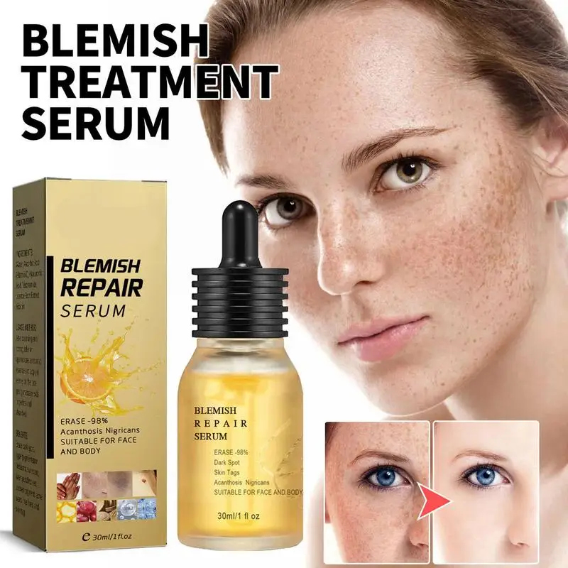 

Blemish Repair Serums Face Hydrates Lighten Dark Spots Rejuvenates And Clarifies Brightening Toner Pigmentation Facial Essence
