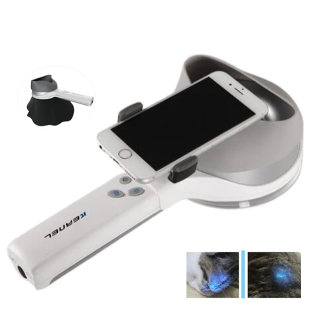 

Medical woods lamp skin analysis portable Skin Analyzer UV Skin Detector dermatology wood lamp