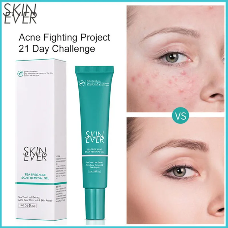 

Tea Tree Pimple Acne Treatment Facial Serum Anti Inflammation Acne Scar Removal Oil Control Shrink Pores Repair Acne Skin Care
