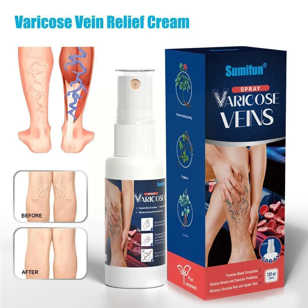 

Effective Varicose Vein Relief Cream Ointment For Varicose Veins To Relieve Vasculitis Phlebitis Spider Pain Treatment W8Q3