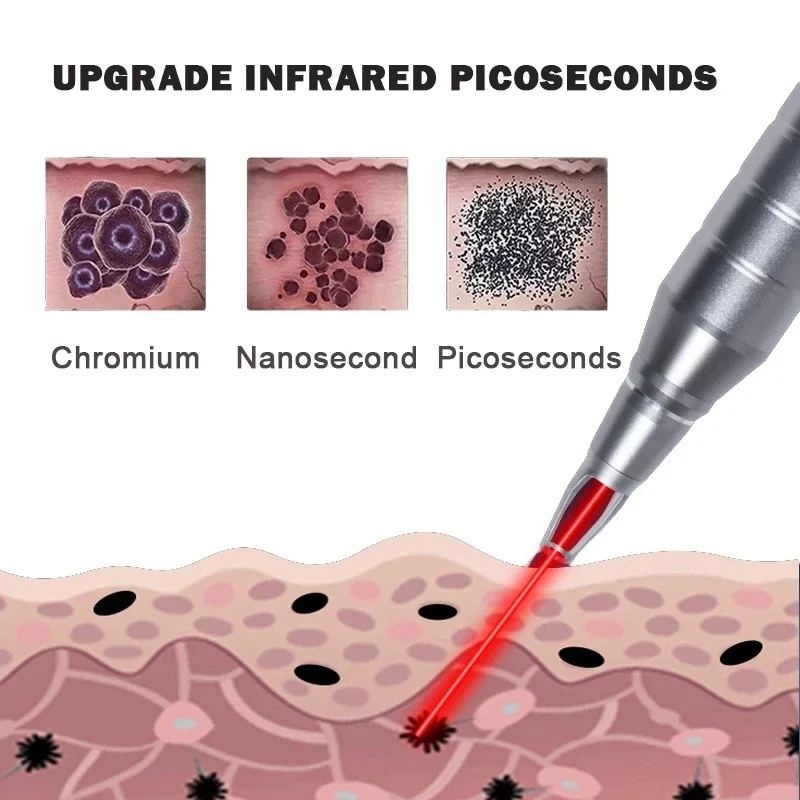 Новейший заводской Nd Yag лазер с переключением Q для удаления татуировок