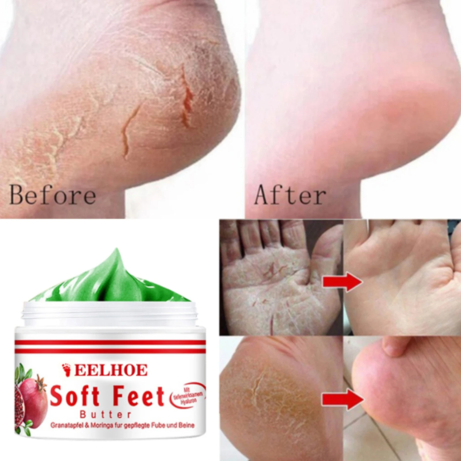 

Pomegranate Hand And Foot Cream Nourishing Deep Moisturizing Hand Cream And Foot Cream For Dry Cracked Heels Rough Dry And