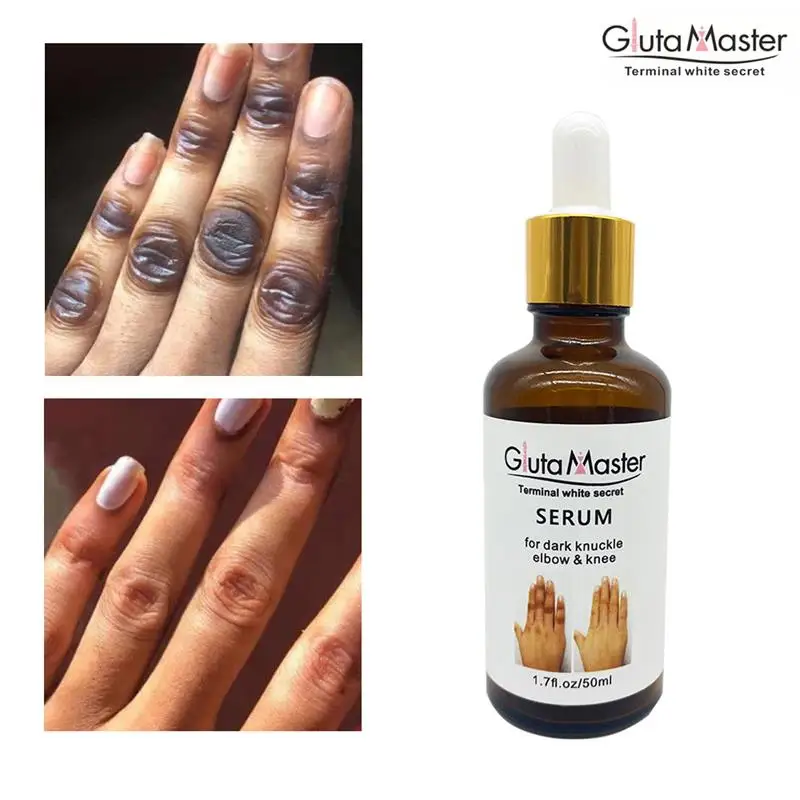 Отбеливающее масло для удаления суставов под темные суставы за 7 дней, средство для очистки, коррекции темных пятен и локтей