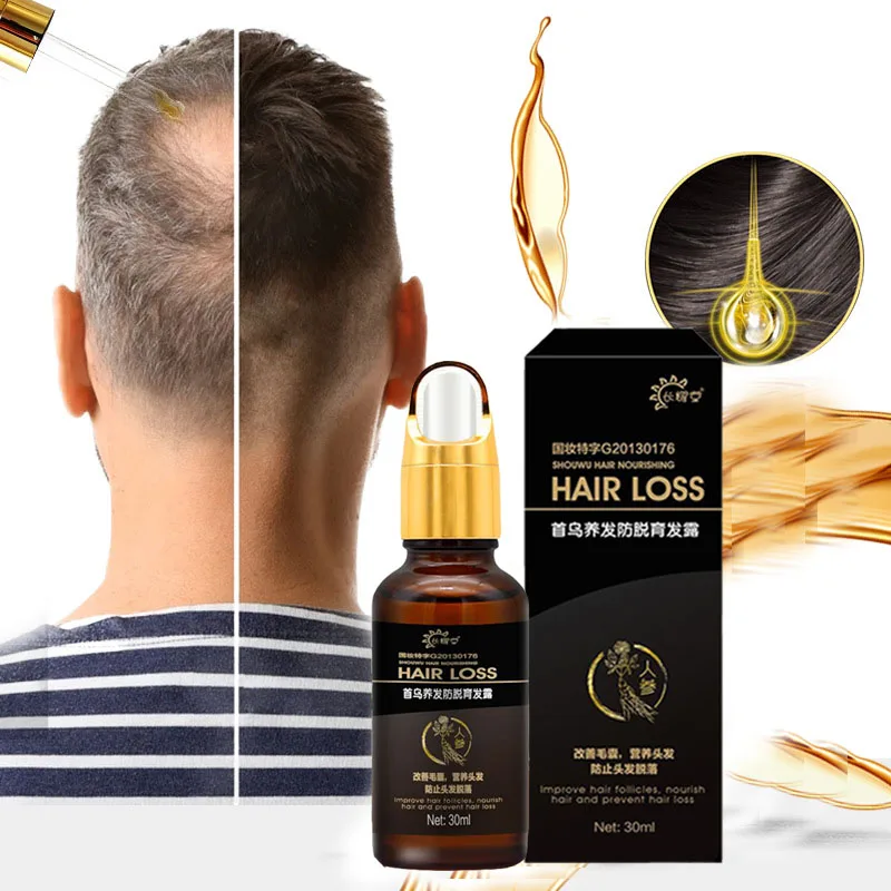 Hair Growth Products Fast Growing Oil Loss Care Liquid Beauty &amp Scalp Treatment Dense Serum |