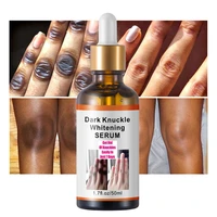 50ml finger joint whitening serum dark knuckles essential oil brightening elbow knee lighten melanin for ankle corner underarm