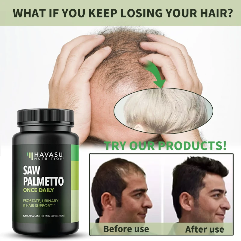 Inhibit Excessive Secretion of Androgen, Balance Hormone Levels, and Relieve Male Hair Loss