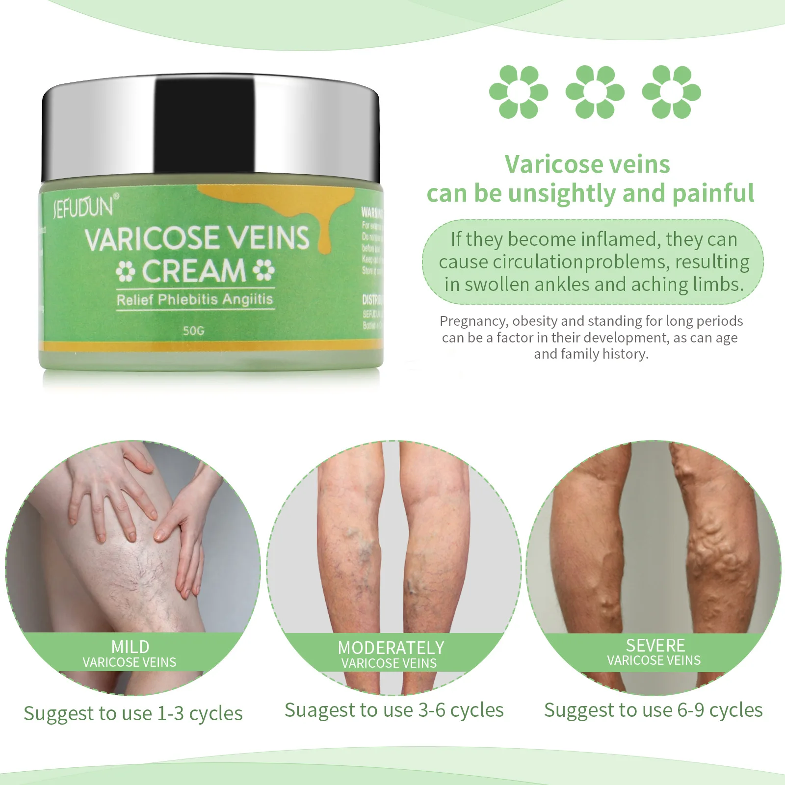 

Varicose Veins Cream,Varicose Vein Treatment for Legs,Relief Phlebitis Angiitis Inflammation,Improve Blood Circulation 50g