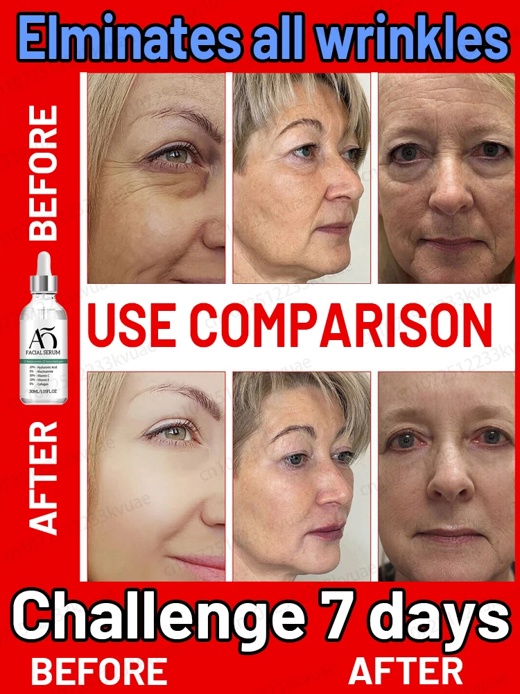 

Moisturizing Whitening and Anti-aging Brighten Skin Tone Lighten Facial Wrinkles Deep Skin Care Effective Anti-Ageing Essence