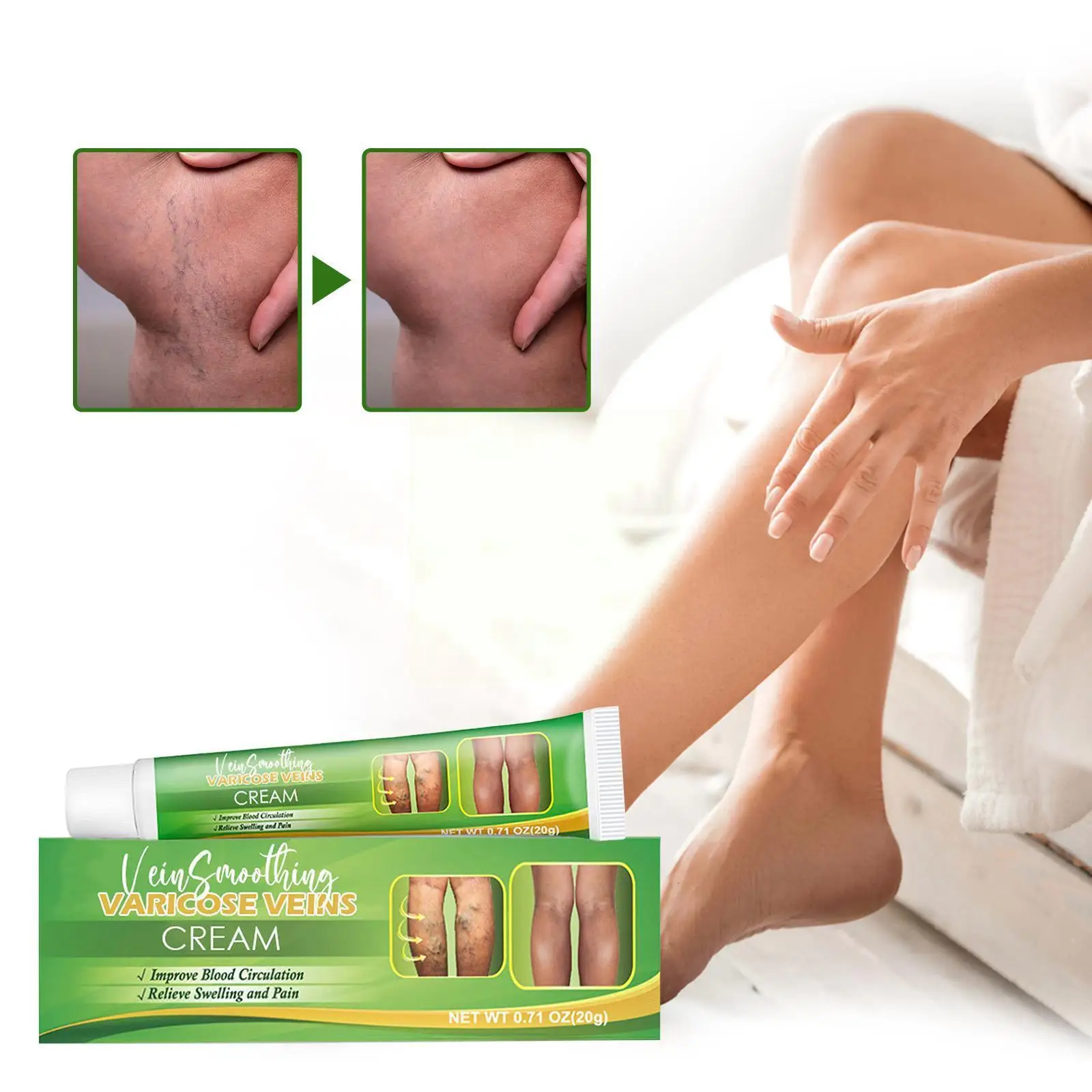 

Varicose Veins Treatment Cream Varicosity Angiitis Leg Spider Phlebitis Plaster Medicinal Vasculitis Herbal Ointment H9F8