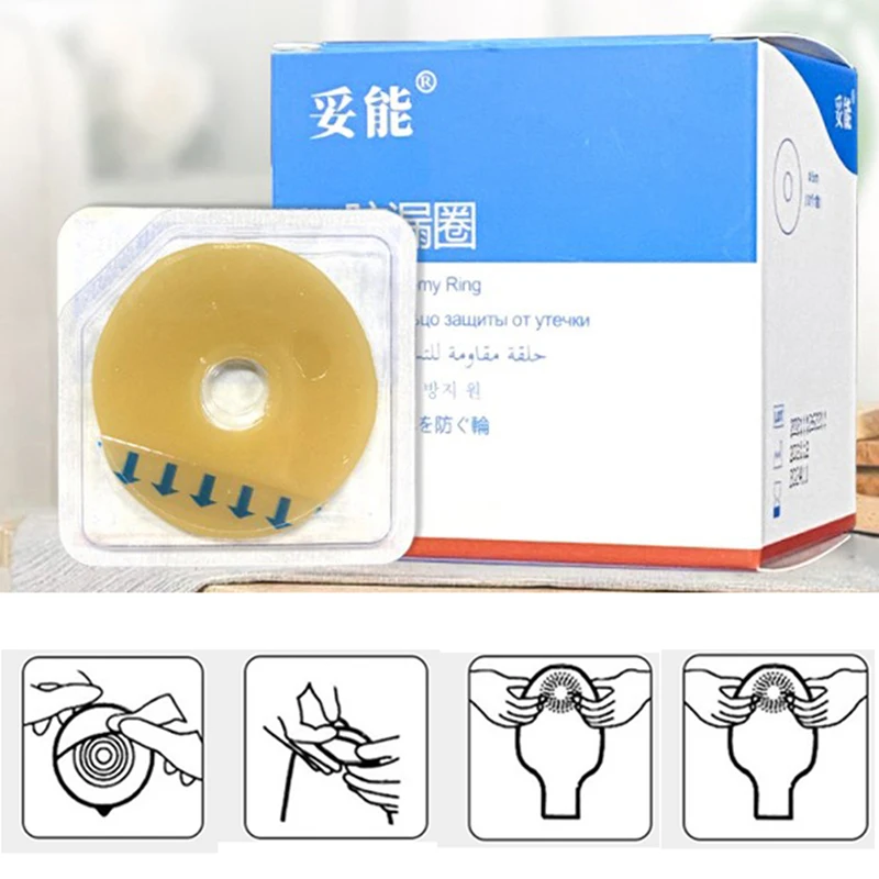 

10pc Ostomy Paste Ring Baseplates Stoma Care Leak-proof Ring For Ostomy Bag Stretch Shaping To Prevent Leakage Protect Skin Care