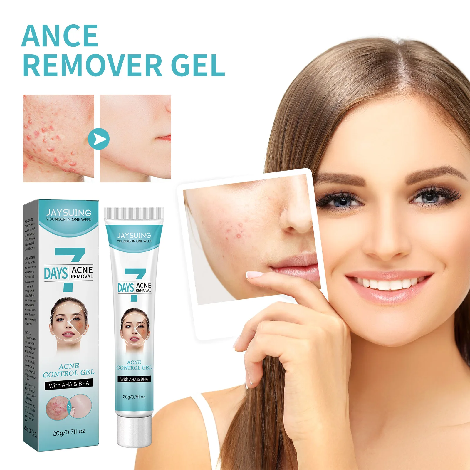 Травяной крем для удаления прыщей уход за кожей лечение традиционной китайской