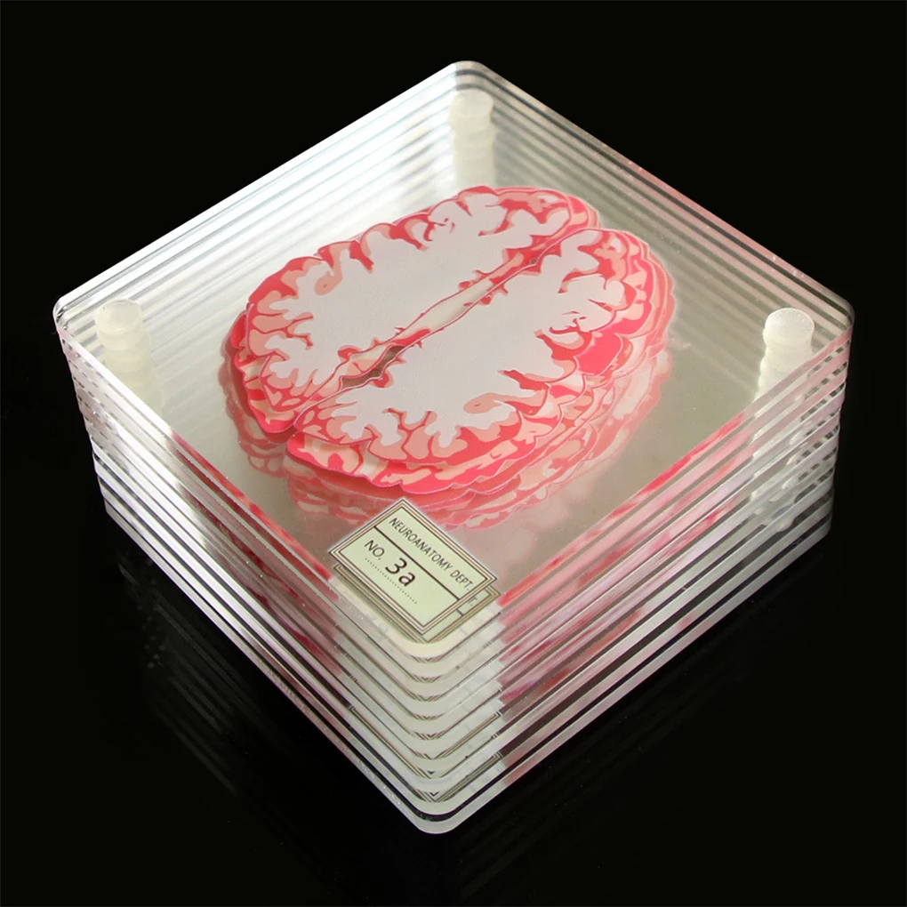 

10PCS Coasters Acrylic Organ Brain Specimen Table Coaster Smooth Lightweight Square Cup Mat Bar Decoration Mugs