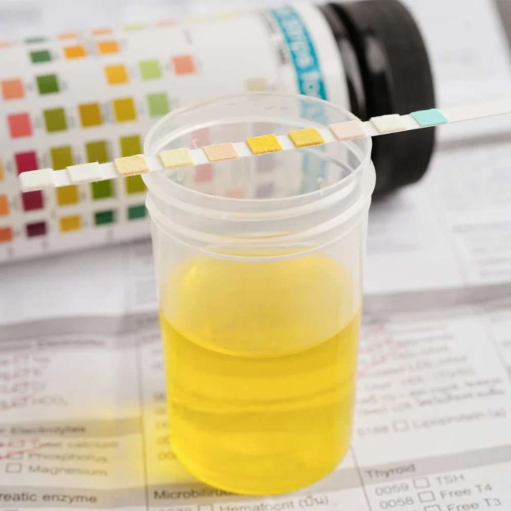 10-параметрические тест-полоски URS-10T для W-200B/W-600/IU-100