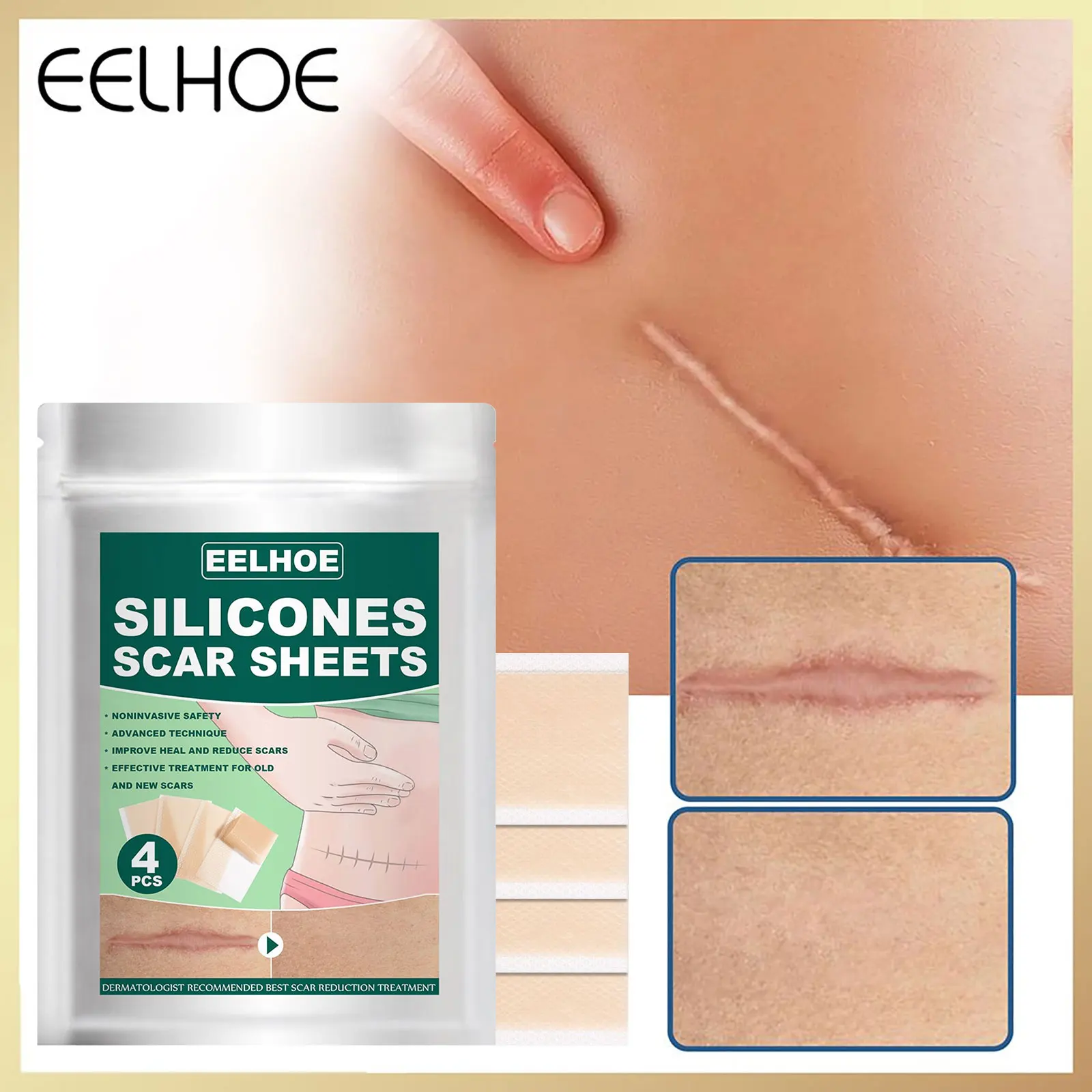 

Eelhoe 4Pcs/Pack Scar Repair Stickers Surgery Stretch Marks Cure Trauma Burn Transparent Repair Skin Silicone Gel Strips Patch