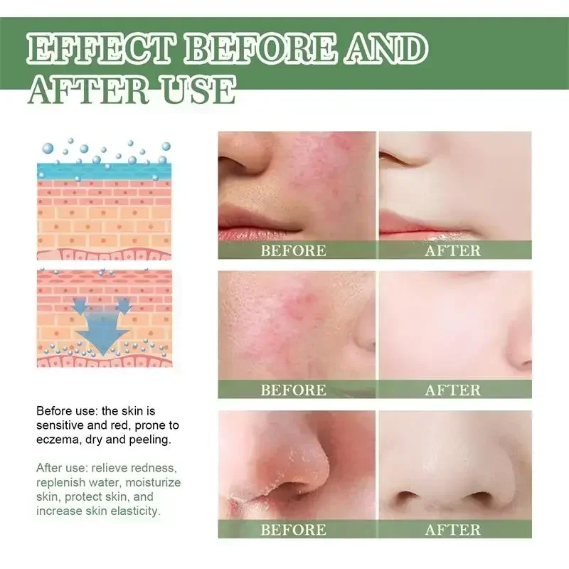 7-дневный восстанавливающий крем для покраснения лица успокаивающий кожу