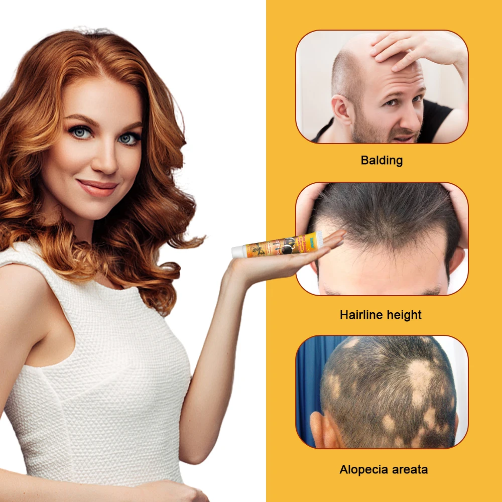 1/3/5/10 шт. Sumifun крем для роста волос алопеция восстановление лысины мазь