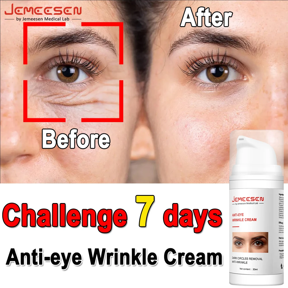 

Eye Care Anti-Wrinkle Eye Cream Rapid Wrinkle Repair Serum for Dark Circles,Fight Fine Lines,Wrinkles Remover Eye Fat Particles
