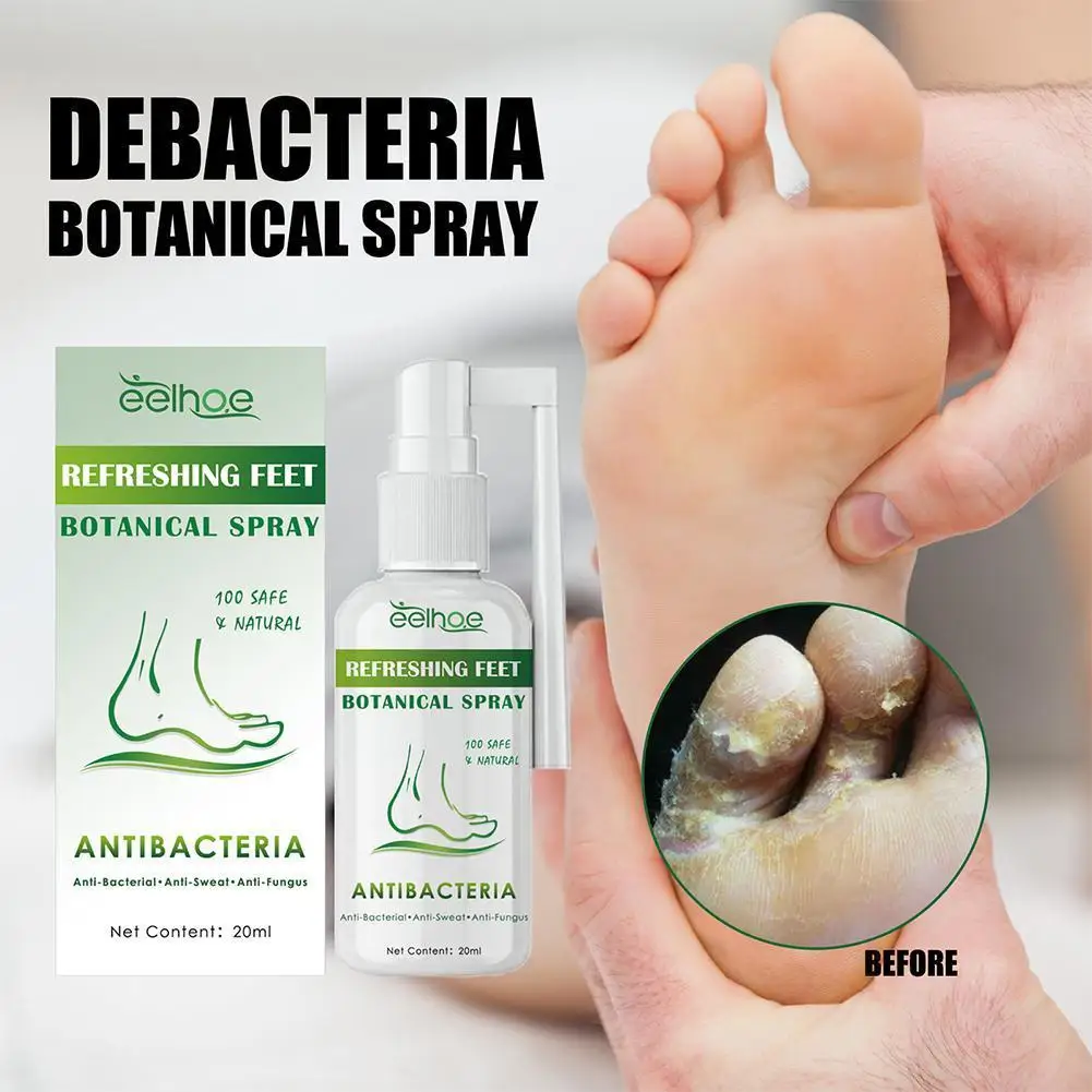 

Anti Fungal Athlete Feet Spray Sterilize Infection Repair Bacterial Paronychia Treatment Foot Anti Toe Onychomycosis D6S2