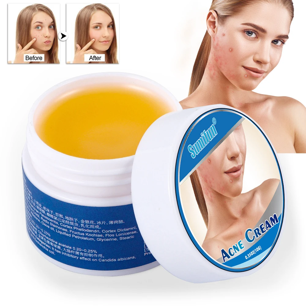 

Herbal Acne Removal Cream Shrink Whitening Face Cream Herbal Acne Oil Control