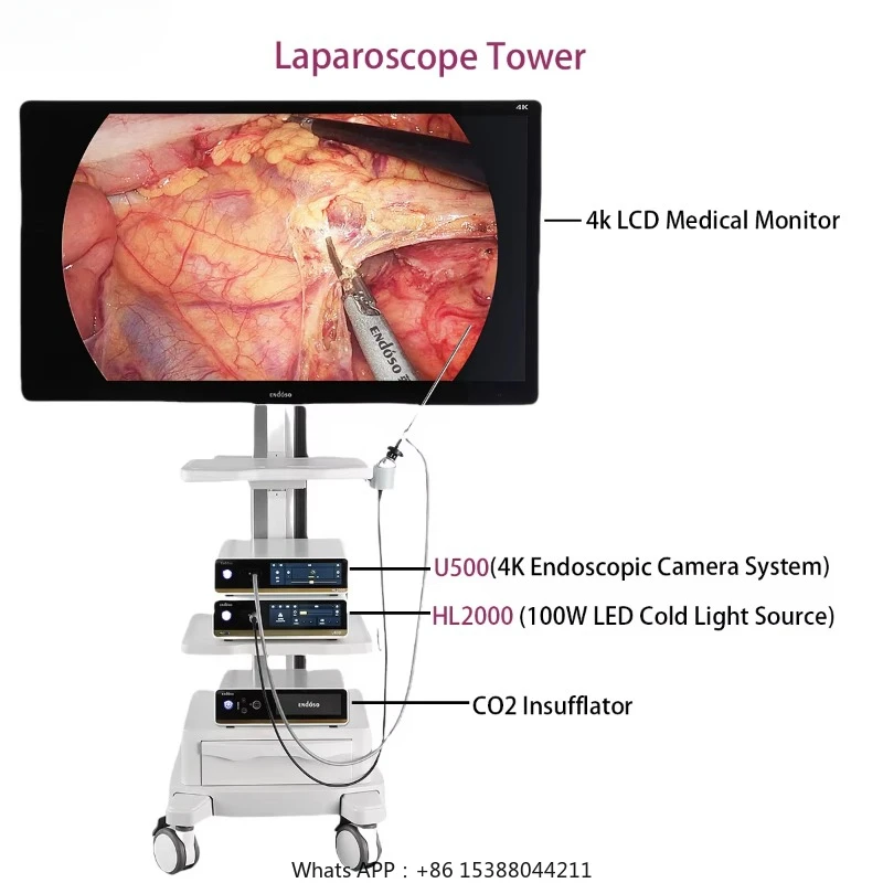 OEM ODM 4K UHD Медицинская видеоэндоскопическая камера эпохи для лапароскопической