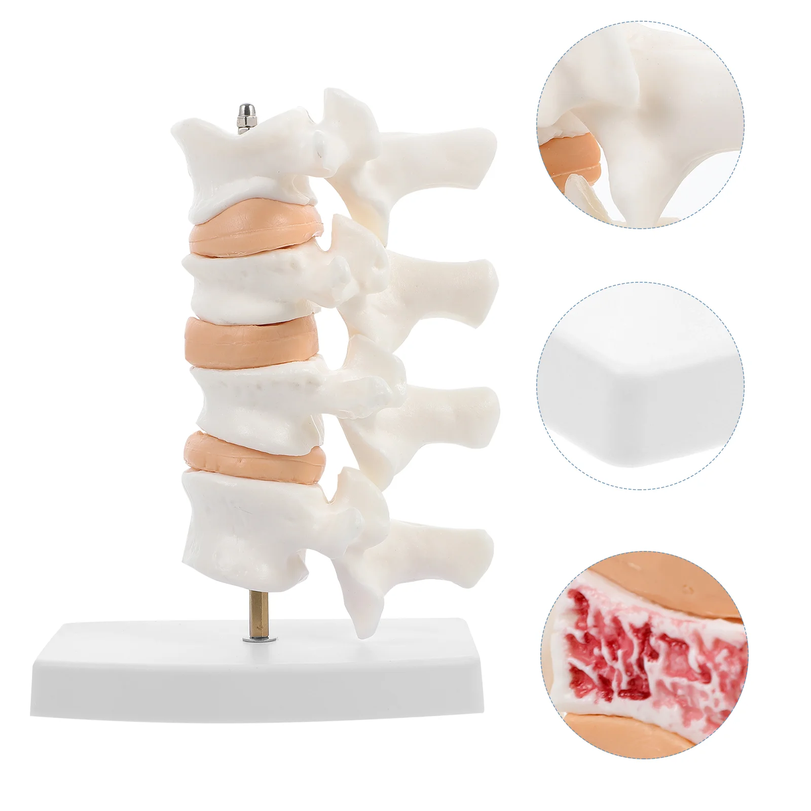 

1pc Osteoporosis Models Good Safe Sturdy Light Model for Display