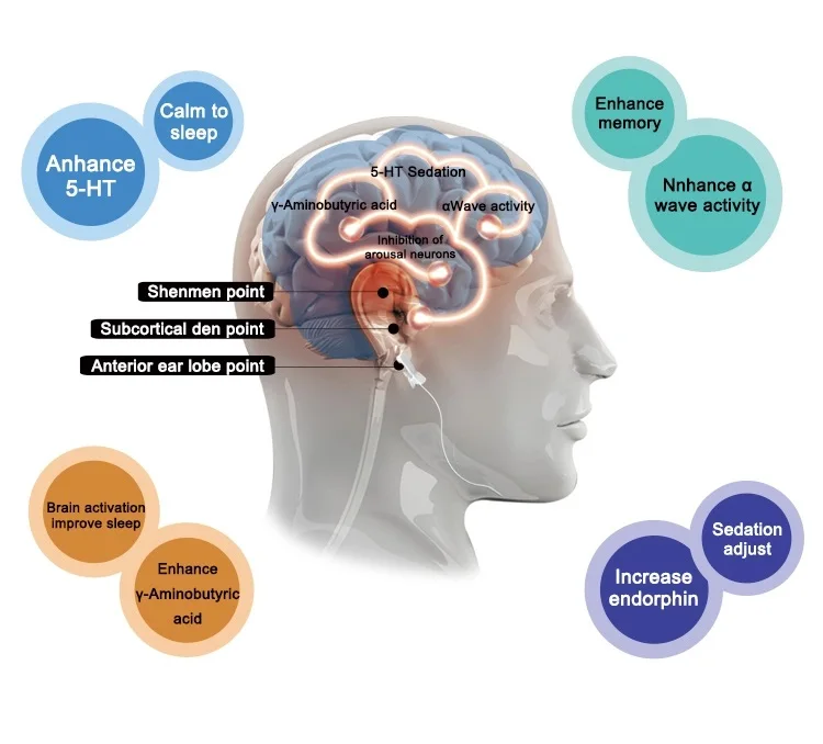 Улучшенное устройство для улучшения сна новые изобретения CES Электротерапия
