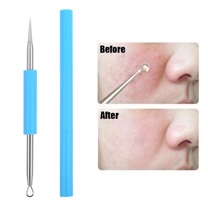 

1PC Acne Clip Set Cell Clip Acne Needle Squeezing Blackhead Pressing Rod Cleaning Facial Stainless Steel Beauty Tool