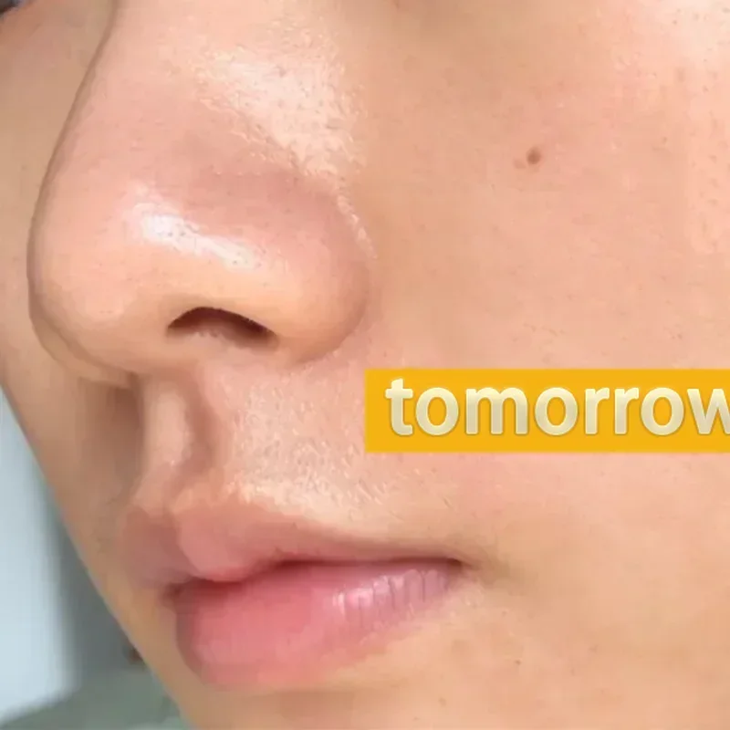 Эссенция для устранения всех пор лица укрепляющая восстанавливающая