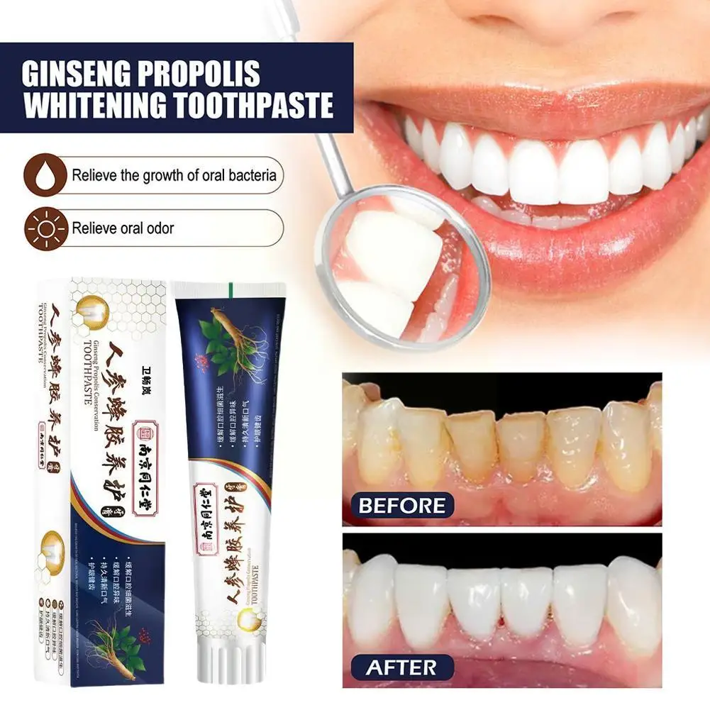 

120g Tooth Decay Whitening Toothpaste To Tooth Stains Quick-acting To Bad Fresh Breath To Whitening Breath Oral Remove Yell Y8Y2