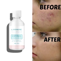 limestone dry emulsion acid removal of acne moisturizing oil control essence skin care