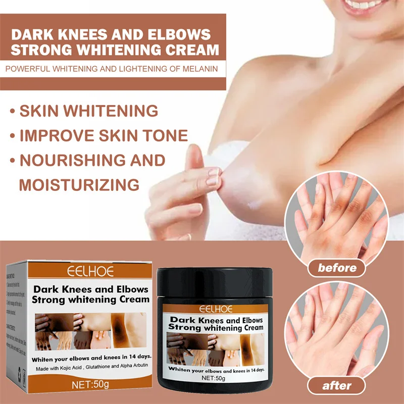 

Dark Knuckles Fast Whitening Cream Pigmentation Correctors For Black Skin Hand Knuckle Elbows Knee Intense Stains Remover Cream