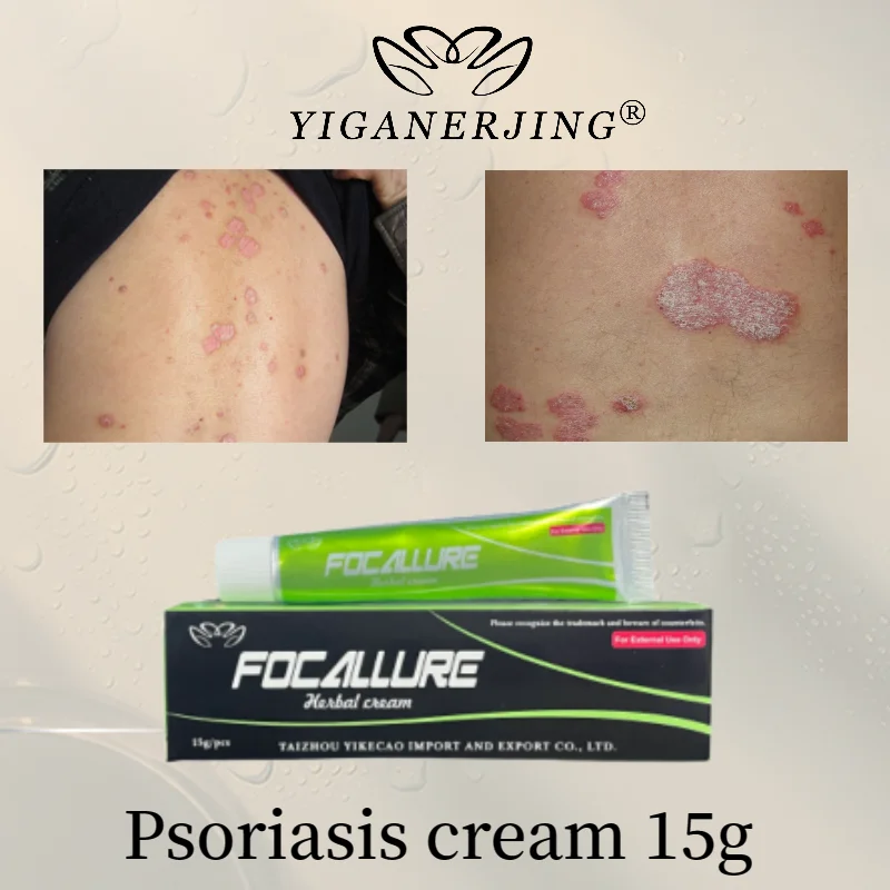 

10pcs Fcollure Psoriasis Cream Yiganerjing Herbal Addition Relieves Skin Problems Such as Eczema Itching 15g