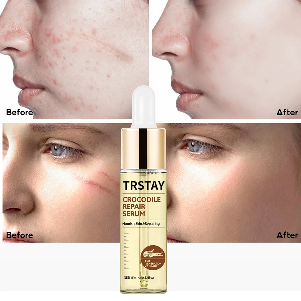 

Crocodile Freckle Serum Face Essence Moisturizing Anti-aging Wrinkle Hyaluronic Acid Serum facial korean skin care products