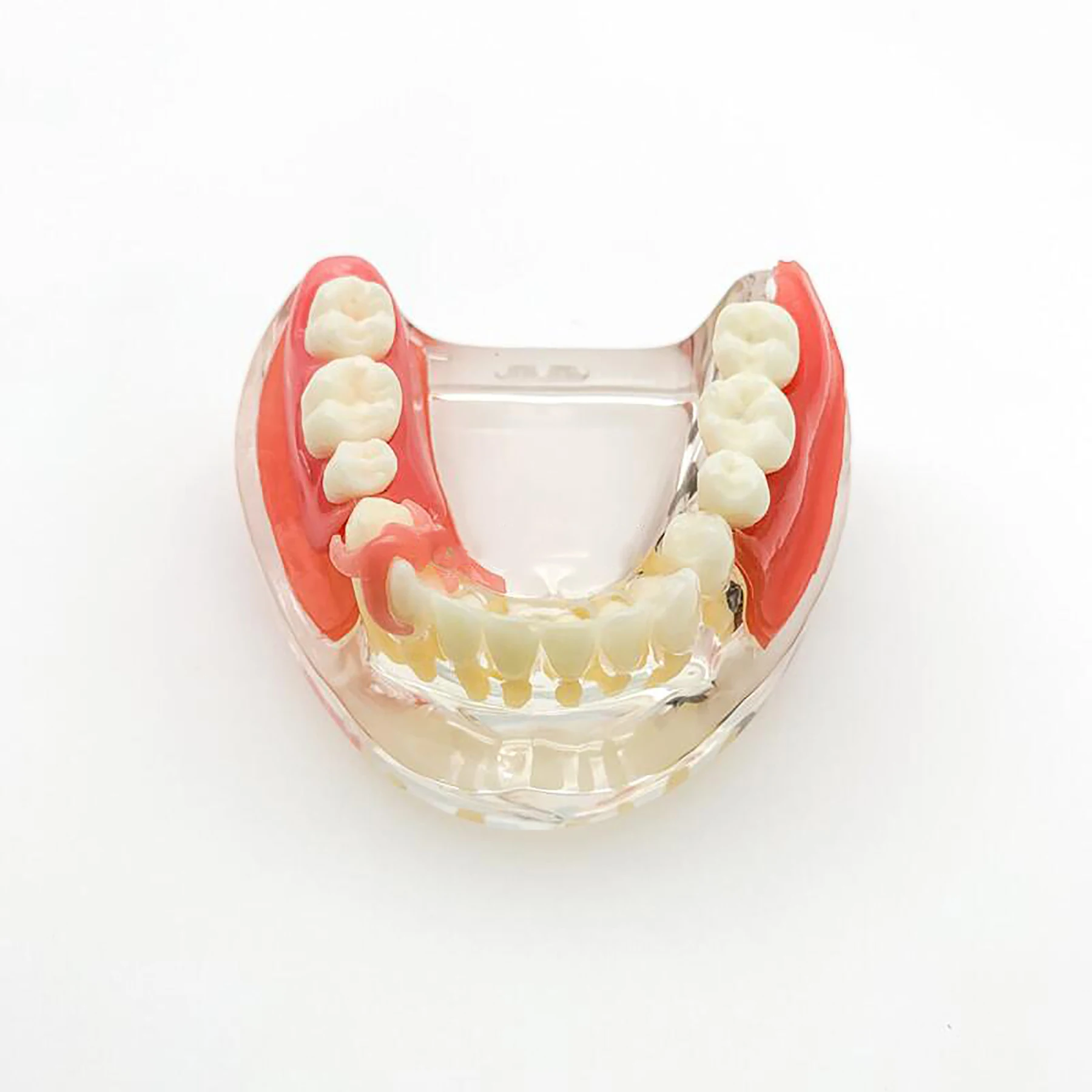 Demos m. Демонстрационная модель имплантата зубного. Модели зубов для реставрации.