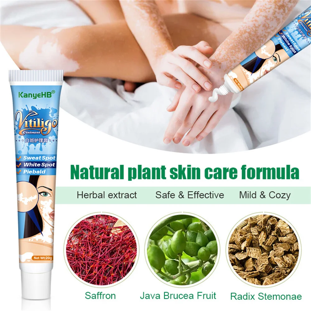 

Newly Vitiligo Removal Cream Vitiligo Cleansing Cream Facial Care Ointment Skin Care White Spot Remove Skin Care-Cream 20g