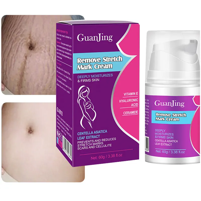 

60g Stretch Mark Vanishing Cream Repair Anti-Wrinkle Anti-Aging Pregnant Women Stretch Marks Treatment Cream Vitamin E Skin Care