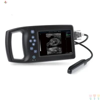 2022 new promotion doppler ultrasound portable color portable color doppler ultrasound scanners portable