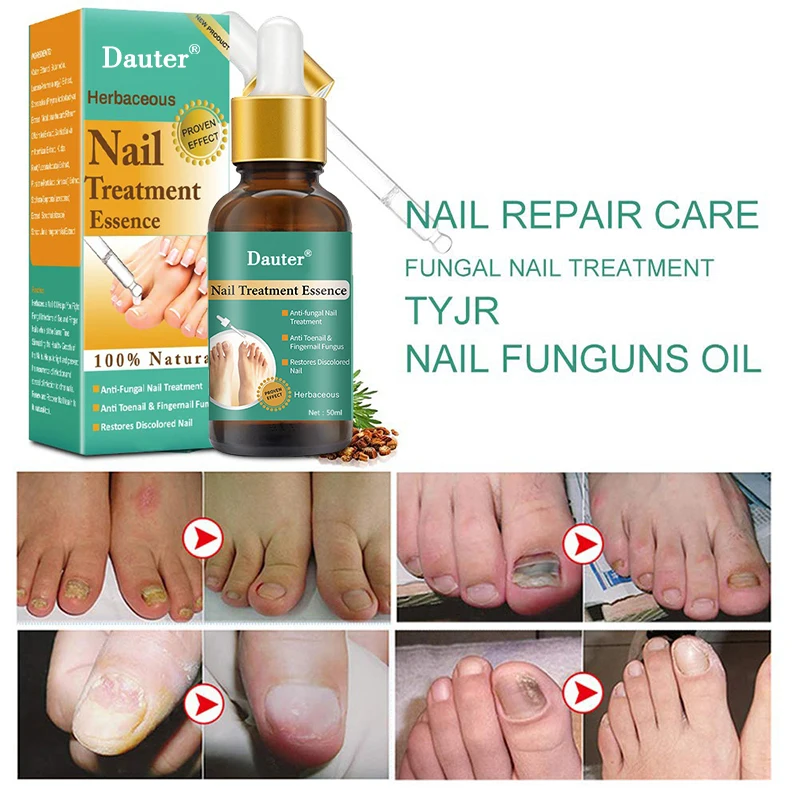 

Dauter Herb Anti Crack Foot Essence Foot Mask Heel Cracked Repair Cream Hand Mositurizing Removal Callus Dead Skin Hands Feet
